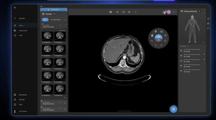 RamSoft’s robust solutions provide Premier with unmatched speed and reliability for reading and processing images for its fast-growing teleradiology operations