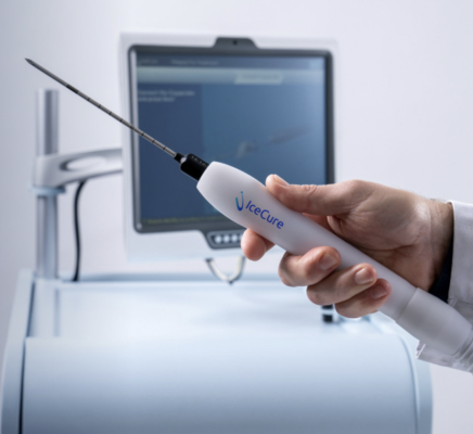 Study represents largest cryoablation study of its kind in the U.S. for early-stage low-risk malignant breast tumors