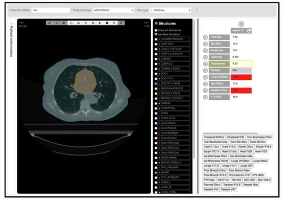 Siris Medical Releases PlanMD Decision Support Software
