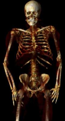 NBA, GE Healthcare Announce First Musculoskeletal Imaging Research Winners 