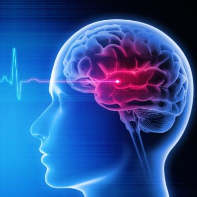 Rapid Response Teams Expedite Stroke Imaging, Treatment