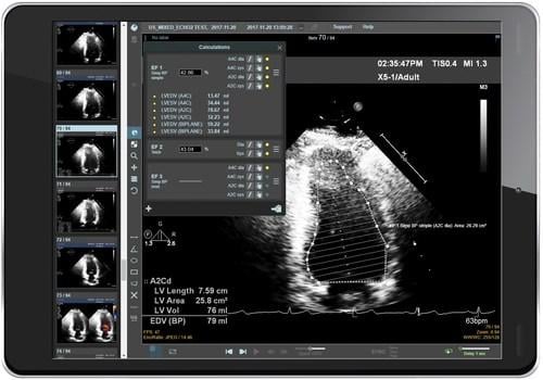 Core Sound Imaging, a leader in cloud-based clinical imaging workflow management, announced the 6.0 release of the company’s innovative cloud-based medical image storage and reporting solution, Studycast. 