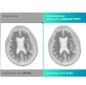 FDA Clears Subtle Medical's Image Acceleration, Enhancement Software