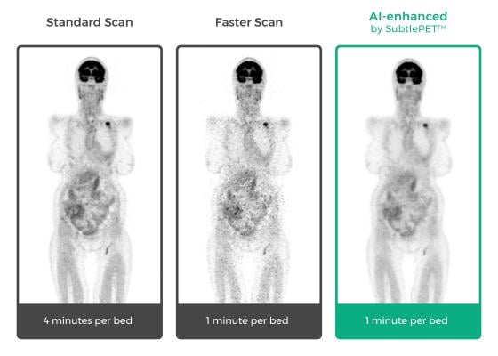 Subtle Medical Showcases Artificial Intelligence for PET, MRI Scans at RSNA 2018