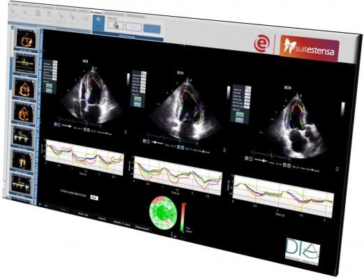 Ebit and DiA Imaging Analysis Partner on AI-based Cardiac Ultrasound Analysis