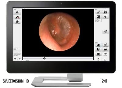 SweetVision HD, endoscope, ThinkTank Technologies