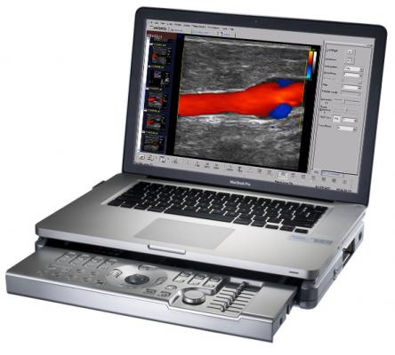 Terason Partners With DiA Imaging Analysis for Point-of-care Cardiac Ultrasound AI