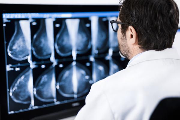 Fewer, larger individual doses of radiation lead to similar adverse effects to normal tissue after 10 years as with conventional radiation therapy for early breast cancer