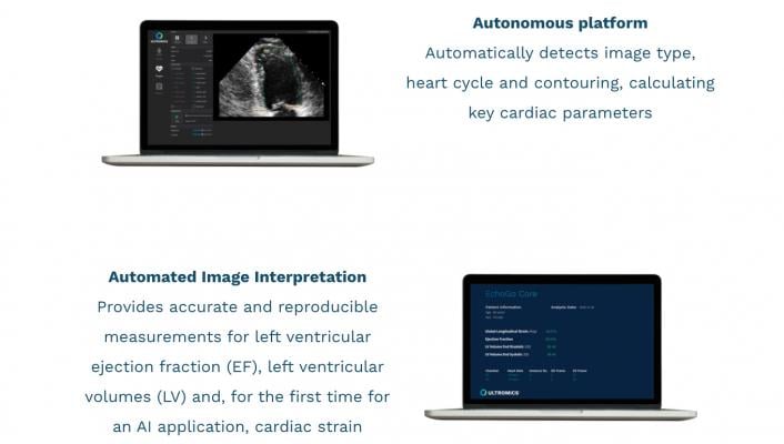EchoGo uses artificial intelligence (AI) to calculate cardiac ultrasound left ventricular ejection fraction (EF), the most frequently used measurement of heart function, left ventricular volumes (LV) and, for the first time for an AI application, automated cardiac strain.