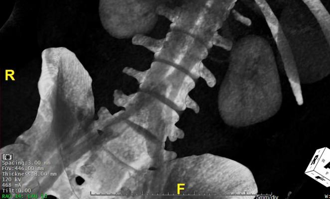 ACR Chooses NDSC to Deliver Comprehensive EHR-Enabled Medical Imaging Clinical Decision Support Platform