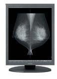 U.S. Electronics Inc. MS35i2 Grayscale Diagnostic Monitor Mammography