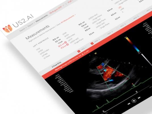 Us2.ai, a Singapore-based medtech firm backed by Sequoia India and EDBI, has received U.S. Food and Drug Administration (FDA) clearance for Us2.v1, a completely automated AI decision support tool for cardiac ultrasound.