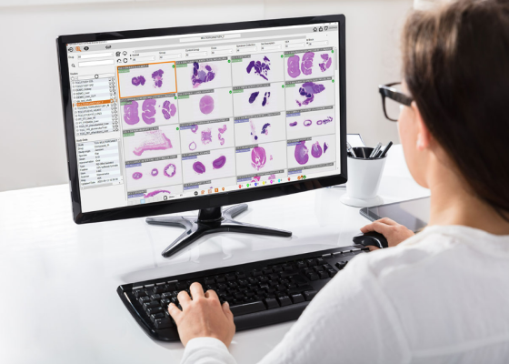 Deciphex, a provider of pathology software and services, has announced the launch of it Digital Research Pathology Platform, Patholytix 3.0. 