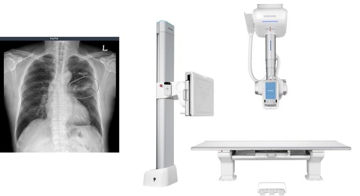 South Korean artificial intelligence (AI) developer, VUNO Inc., announced that the company closed a deal with global medical device manufacturer, Samsung Electronics Co., Ltd., to embed VUNO’s artificial intelligence-driven chest X-ray diagnostic solution, VUNO Med-Chest X-ray into Samsung’s GC85A premium ceiling type digital radiography system. 