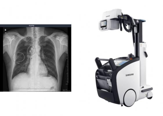 VUNO’s road-tested, clinically-proven chest X-ray detection software is reshaping the delivery of medical imaging diagnostics by being fully integrated with Samsung Electronics’ X-ray system