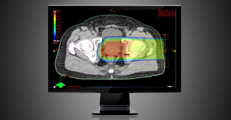 Varian Outlines Strategy for AI-Driven Multimodality Adaptive Radiotherapy Suite