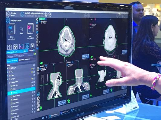 MD Anderson and Varian Partner to Optimize Radiation Oncology Treatment