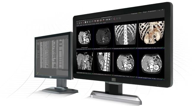 Partners HealthCare Chooses Visage 7 for Enterprise Imaging