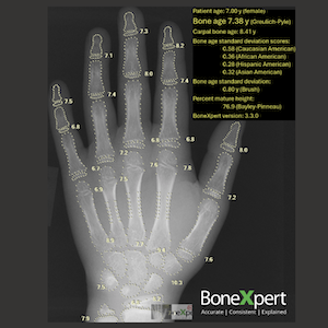 Pediatric Bone Imaging Software Gets FDA Nod
