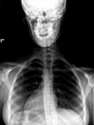 ct systems x-ray systems eos imaging shriners hospital