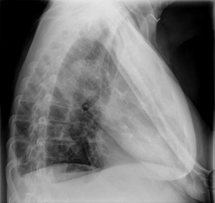 Emory University Hospital, imaging, Ebola, patients