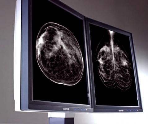 Joint Venture Partnership Opening 16 New Breast Screening Sites in Texas