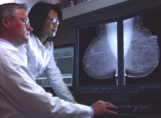 digital mammography, age 50, risks, radiation-induced breast cancer, Annals of Internal Medicine