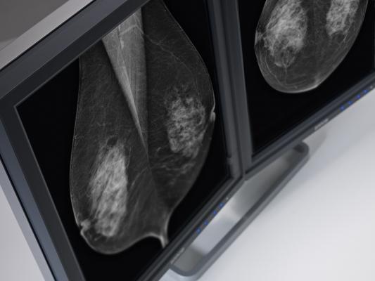 Barco tomosynthesis 5mp mammography systems flat panel displays