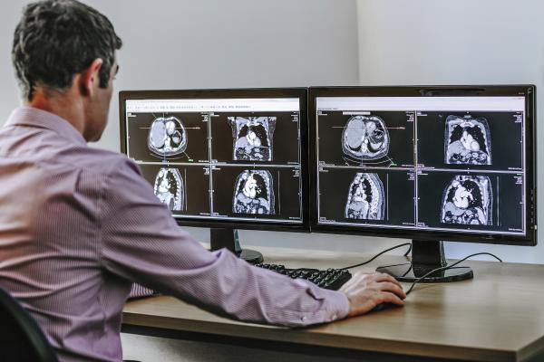 Clinical Trial/Study, Radiation therapy, RSNA 2014, Mass General