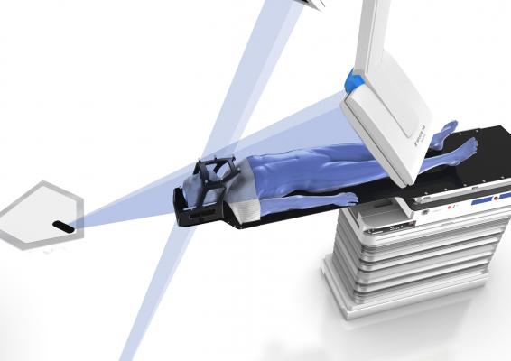 Brainlab, ExacTrac, Versa HD, Elekta, LMU, Munich, LINAC, first