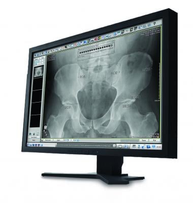 pacs digital radiography dr systems orthopedic imaging rsna 2013 carestream