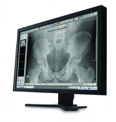 Carestream ImageSuite Software Imaging Orthopedic Imaging
