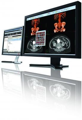 Carestream PACS Remote Viewing systems Digital radiography DR