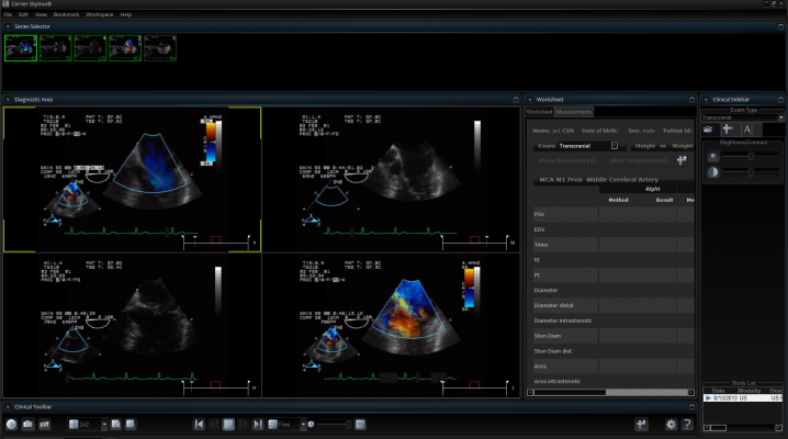 pacs remote viewing systems rsna 2013 cerner skyvue