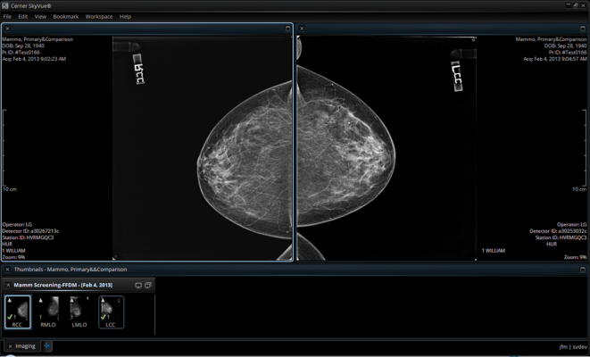 mammography reporting software breast imaging workstations cerner radnet RSNA