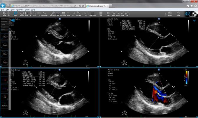 Claron Partnership With Leading Italian Telehealth System Provider Nil Products