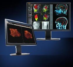 Double Black Imaging Introduces New Clinical Displays