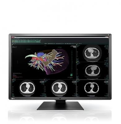 Eizo, RadiForce RX660 medical monitor, RSNA 2016, 6-megapixel