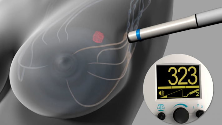 The Magtrace and Sentimag Magnetic Localization System uses magnetic detection during sentinel lymph node biopsy procedures to identify specific lymph nodes, known as sentinel lymph nodes, for surgical removal. The FDA granted approval of the Sentimag System to Endomagnetics Inc.