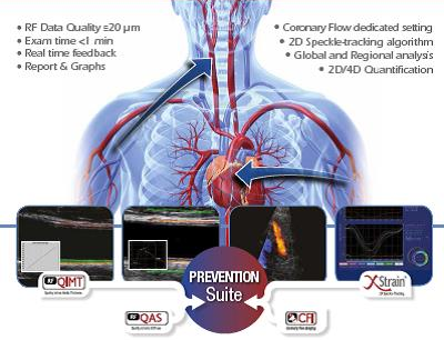 ultrasound systems cardiovascular esaote prevention suite euroecho RF