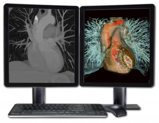 Fovia Visual Medica Advanced Visualization