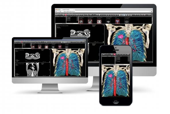 Voyager Integrates HDVR Into Fovia Web-enabled PACS