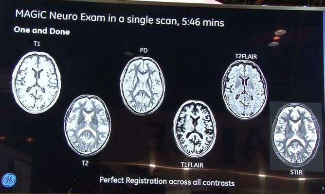 Magic, sigma Pioneer, GE, multiple contrasts in one MRI scan