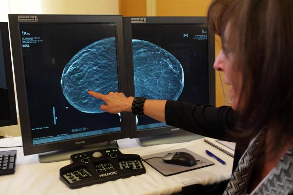 Hologic Receives FDA Approval for Low-Dose 3-D Mammography 