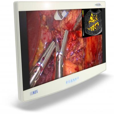 NDS, endoscopic imaging, ZeroWire Mobile, Radiance Ultra 4K