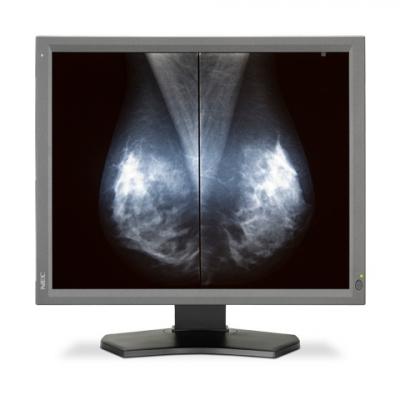 ECOG-ACRIN, TMIST, Tomosynthesis Mammography Imaging Screening Trial, site recruitment, RSNA 2016