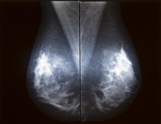 Novarad, NovaMG, mammography viewer, NovaPACS