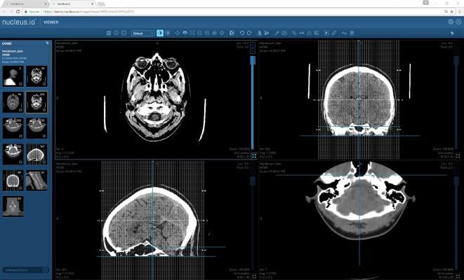 NucleusHealth Receives FDA 510(k) Clearance for Nucleus.io