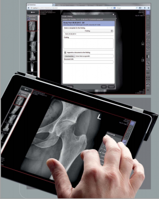 Leonardo DR nano system, X-ray systems, Digital Radiography systems