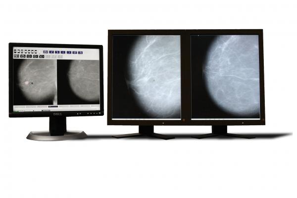 Parascript, AccuDetect 7.0, FDA approval, computed-aided detection for mammography